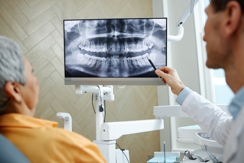 Tooth Extraction in Atkins, AR | Dr. Aaron Bratton