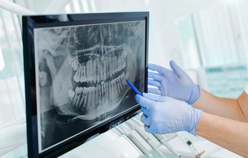 Digital X-Ray in Atkins, AR | Accurate Imaging for Better Results
