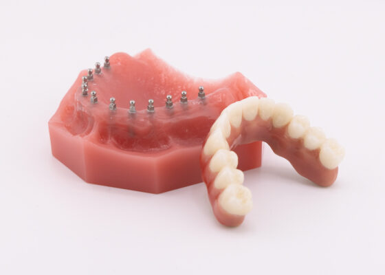 Zirconia Teeth in Atkins, AR | Book a FREE Implant Consultation!