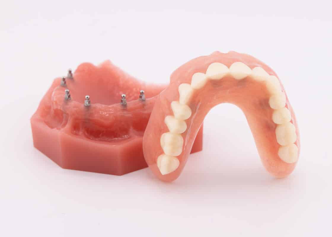 Denture Stabilization in Atkins, AR | Book a Free Consultation