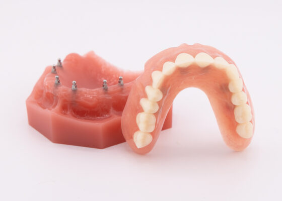Denture Stabilization in Atkins, AR | Book a Free Consultation