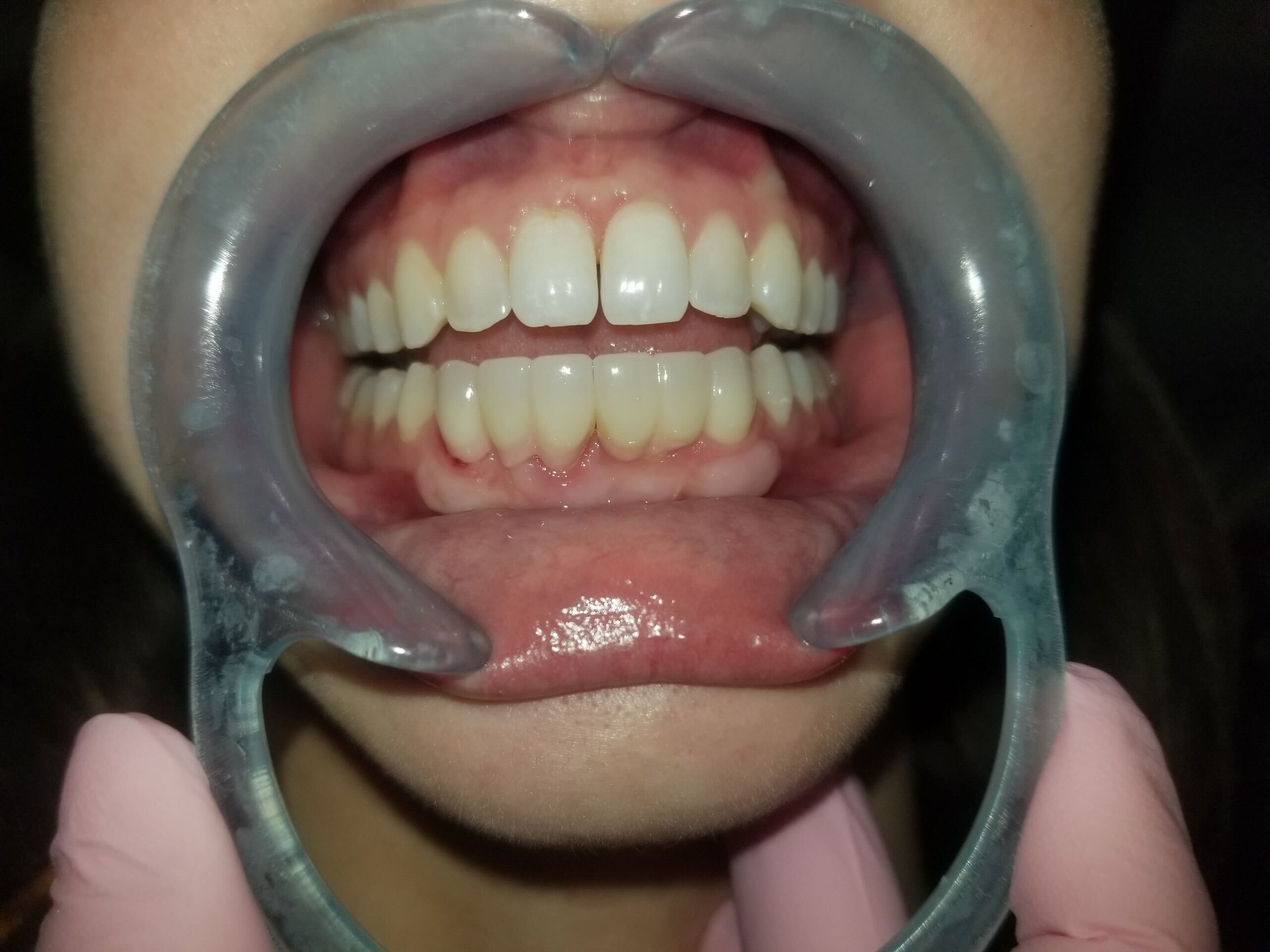 Atkins Dental Clinic - Before & After 2